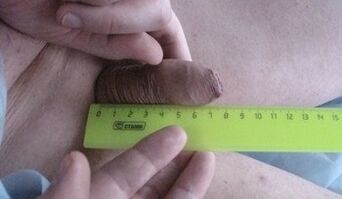 mesure de la taille du pénis